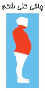 دلیل چاقی کلی شکم